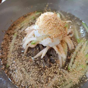 배꼽 사진