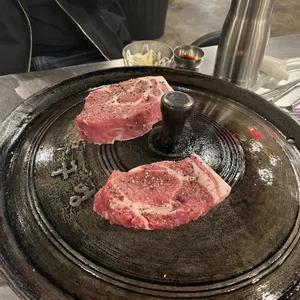 목구멍 사진