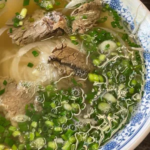 포옹남 사진