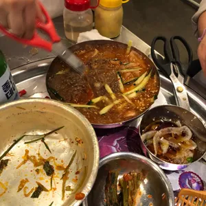 목구멍 사진