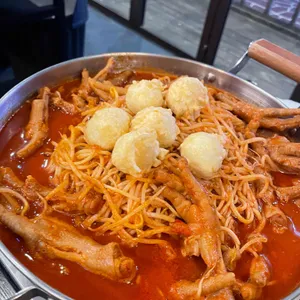 술비 사진