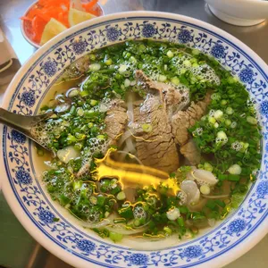 포옹남 사진