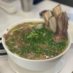 포레스트 오늘 숲 사진