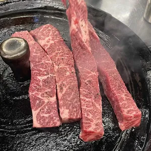 목구멍 사진