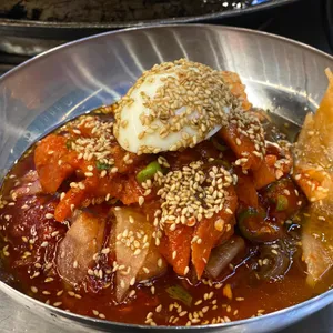 목구멍 사진
