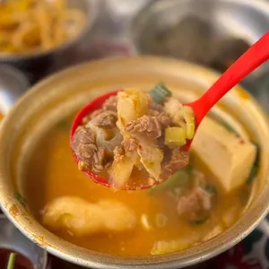 목구멍 사진
