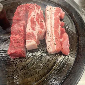 목구멍 사진