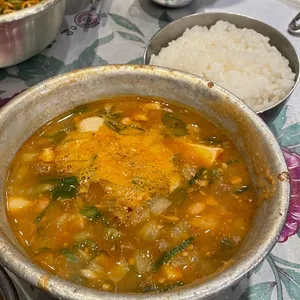 목구멍 사진