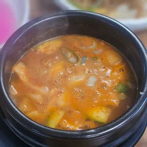 배꼽 사진
