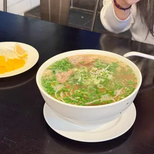 포레스트 사진