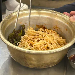 목구멍 사진