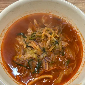 태동반점 사진