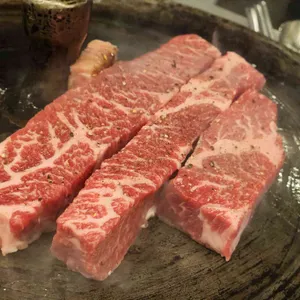 목구멍 사진