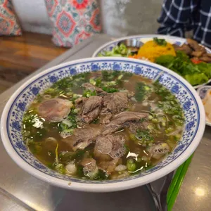 포옹남 사진