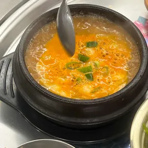 목구멍 사진
