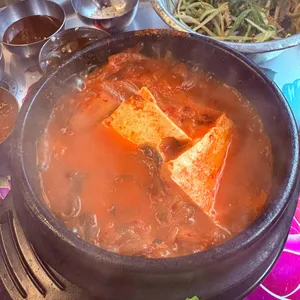 목구멍 사진