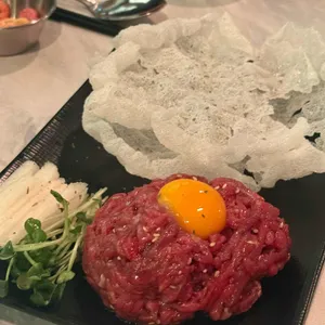 알콜중독 대표 사진