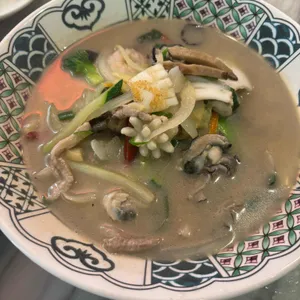 팅팅 대표 사진