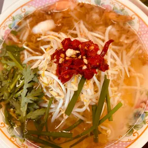 서보 대표 사진