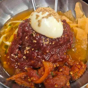 목구멍 대표 사진