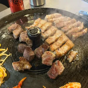 목구멍 대표 사진