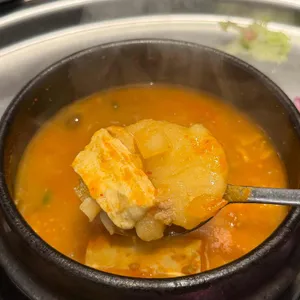 목구멍 대표 사진