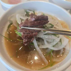 우설화 대표 사진