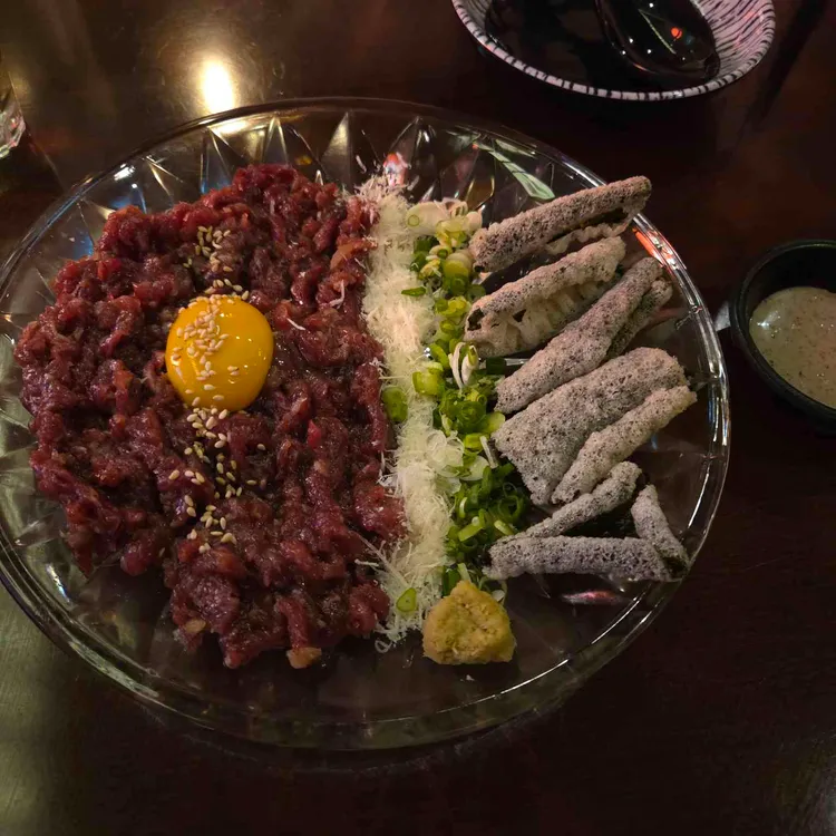 시선 사진
