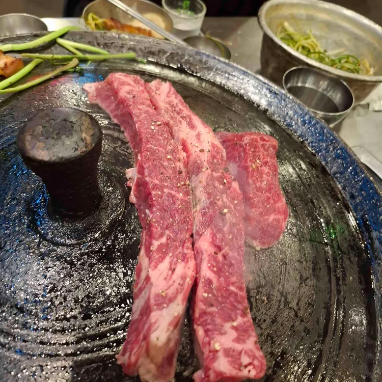 목구멍 사진