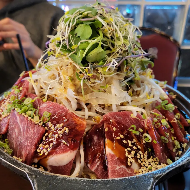 시선 대표 사진