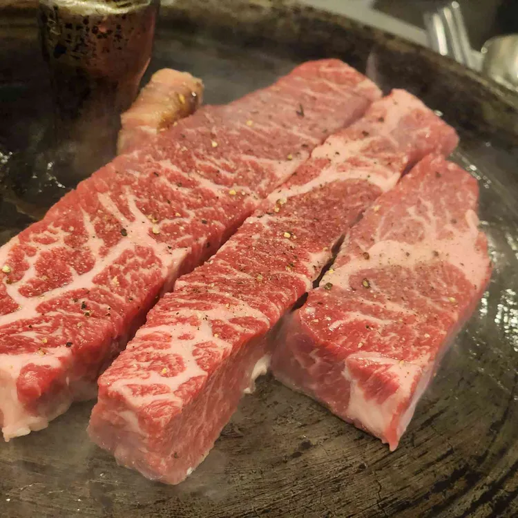 목구멍 대표 사진