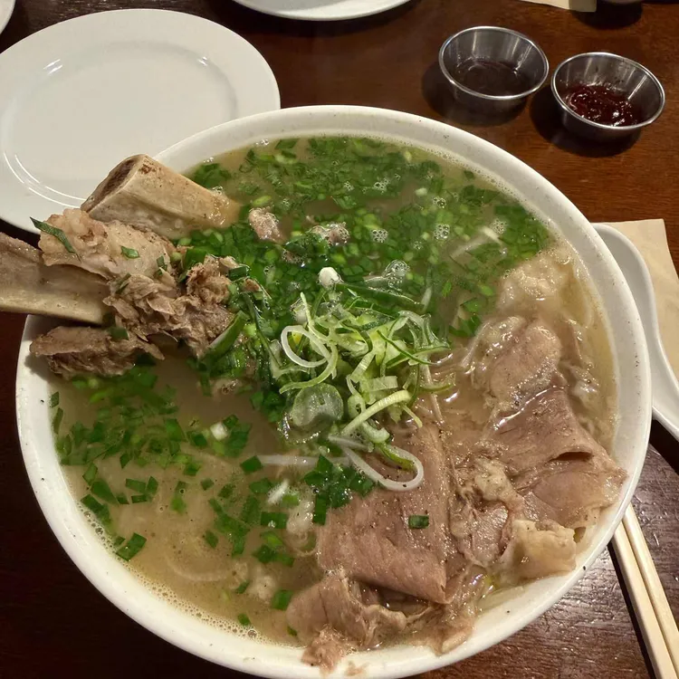 포레스트 사진
